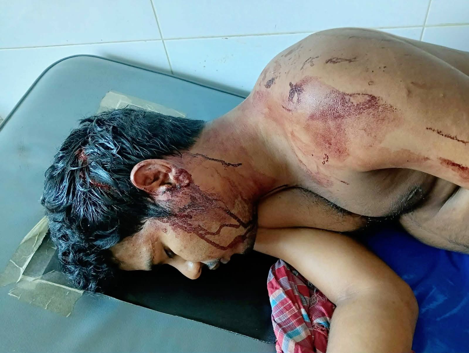 গোপালগঞ্জ সরকারি কলেজ ছাত্রাবাসে হামলা, হত্যাচেষ্টার অভিযোগে ভুক্তভোগীর লিখিত অভিযোগ দায়ের
