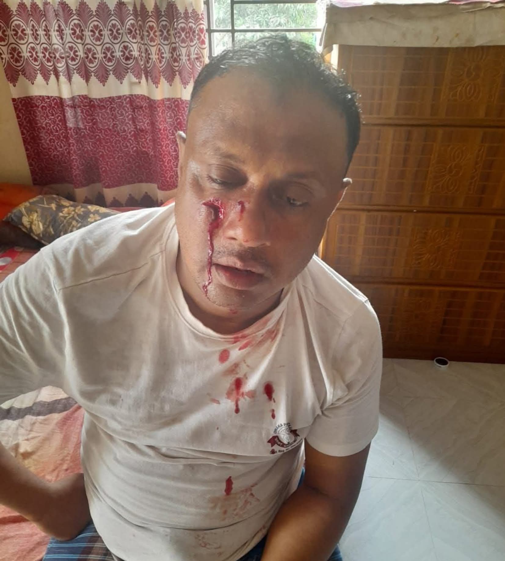 গাজীপুরে সাংবাদিকের উপর সন্ত্রাসী হামলা