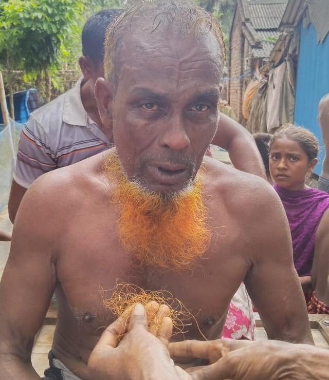 পাইকগাছায় গাছের ডাব খাওয়াকে কেন্দ্র করে এক বৃদ্ধাকে বিদ্যুৎ’র খুঁটিতে বেঁধে মারপিটের অভিযোগ