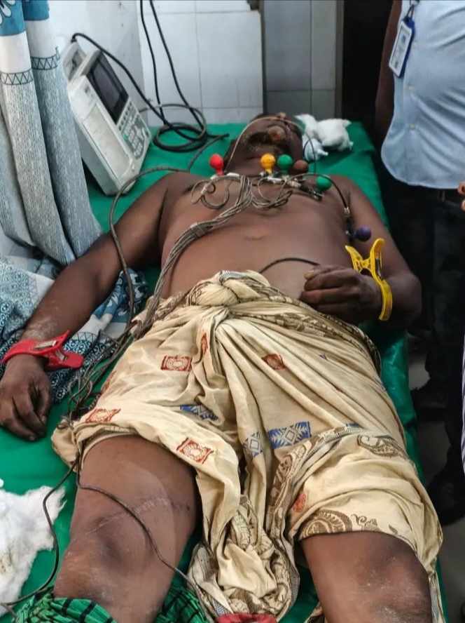 মাগুরায় ঘাস কাটার সময় সাপের কামড়ে কৃষকের মৃত্যু : এলাকায় আতঙ্ক
