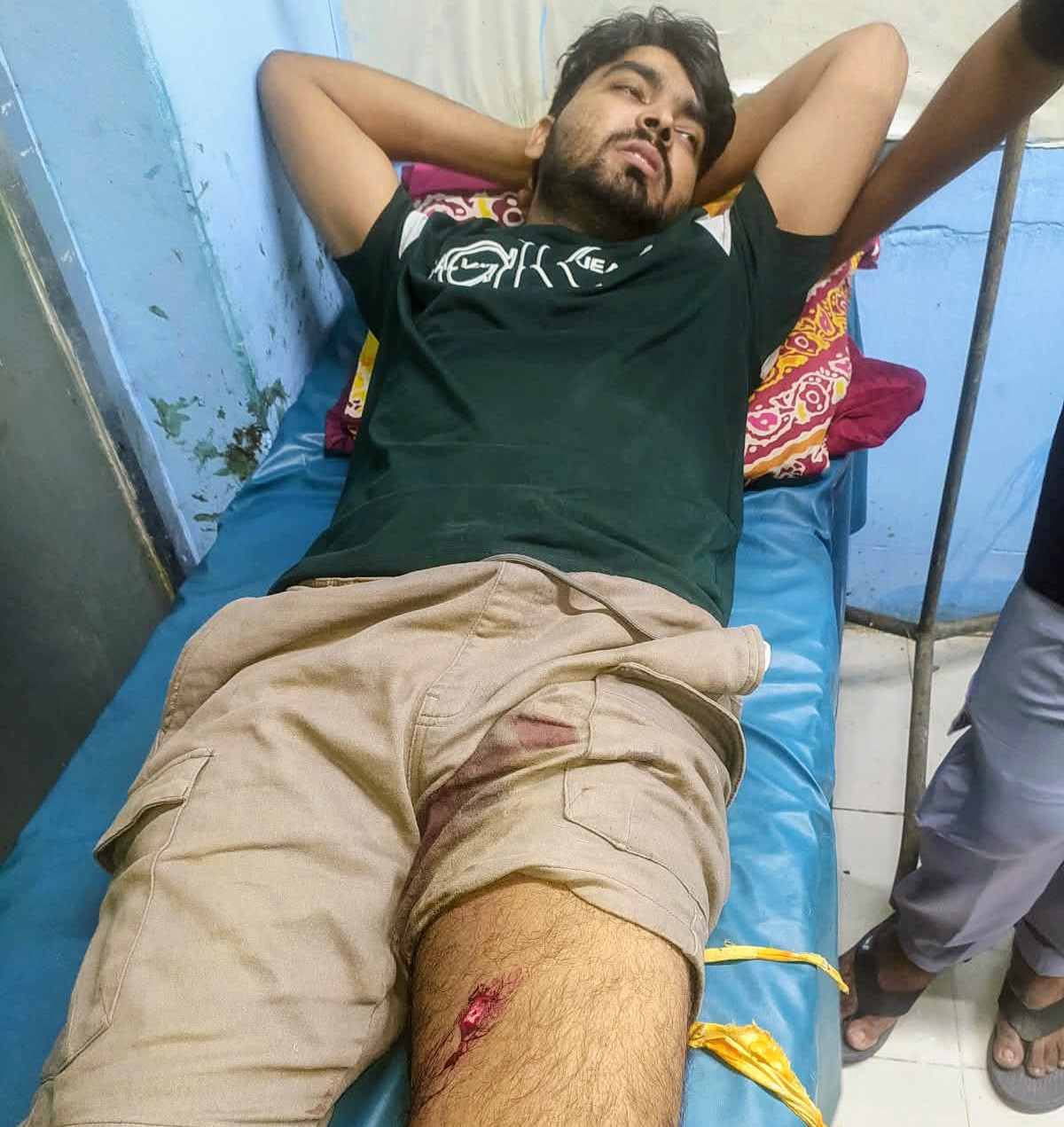 খুলনায় দুর্বৃত্তদের গুলিতে যুবক আহত : মোবাইল ফোন ছিনতাই
