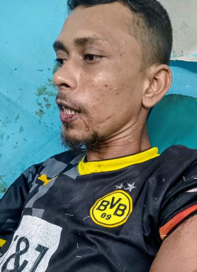 খুলনায় ছিনতাইকারীদের ছুরিকাঘাতে রং মিস্ত্রি জখম, টাকা-মোবাইল ছিনতাই