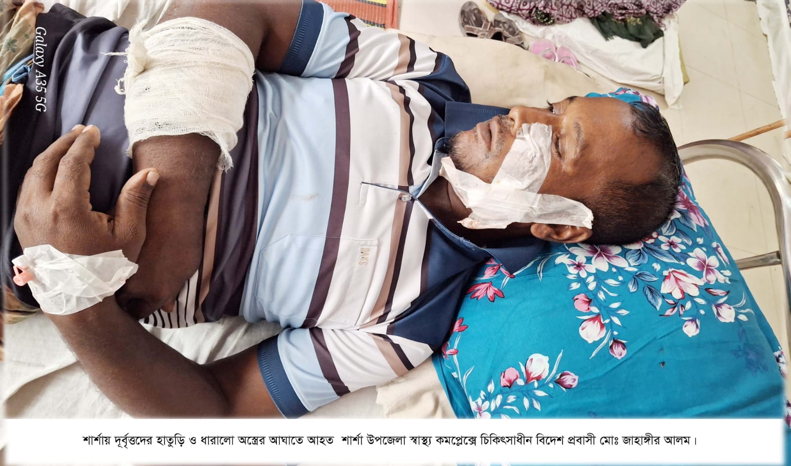 শার্শায় একই পরিবারের ৪ জনকে কুপিয়ে জখম, বাড়িঘর ভাঙচুরসহ স্বর্ণালংকার ও নগদ টাকা লুটের অভিযোগ