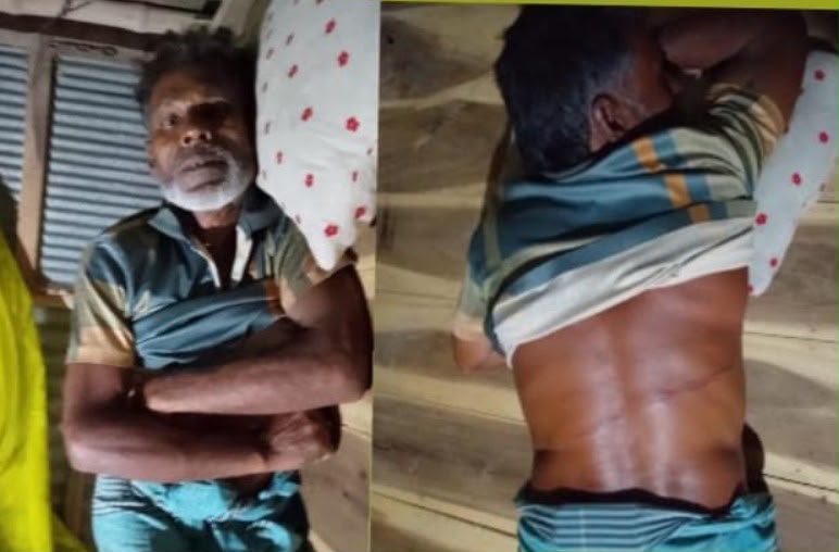 খুলনার ডুমুরিয়ায় সুদের টাকার দাবিতে এক ভ্যানচালকের ওপর হামলা