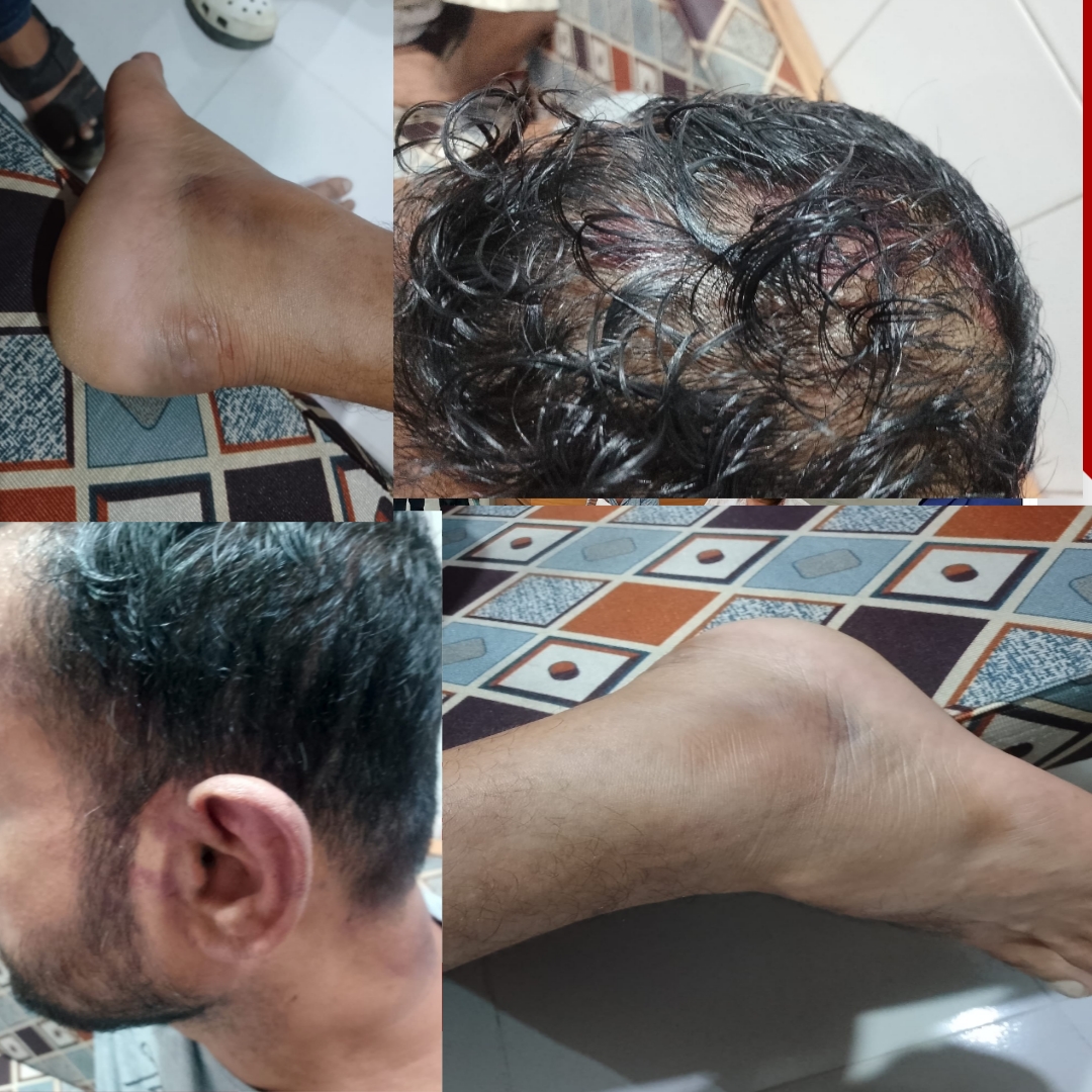 ফকিরাপুলে সন্ত্রাসী তাণ্ডব : ​মাদকের সুবিধা না দেওয়ায় হোটেলে হামলা, মালিকসহ রক্তাক্ত ৪